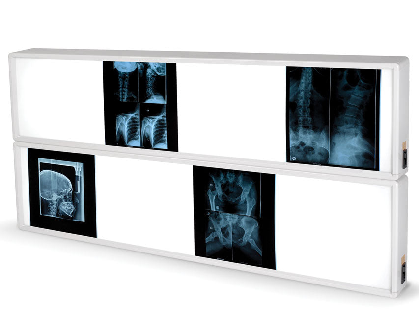 NEGATIVESCOPE 2x4 PANELES 76 x 153 cm